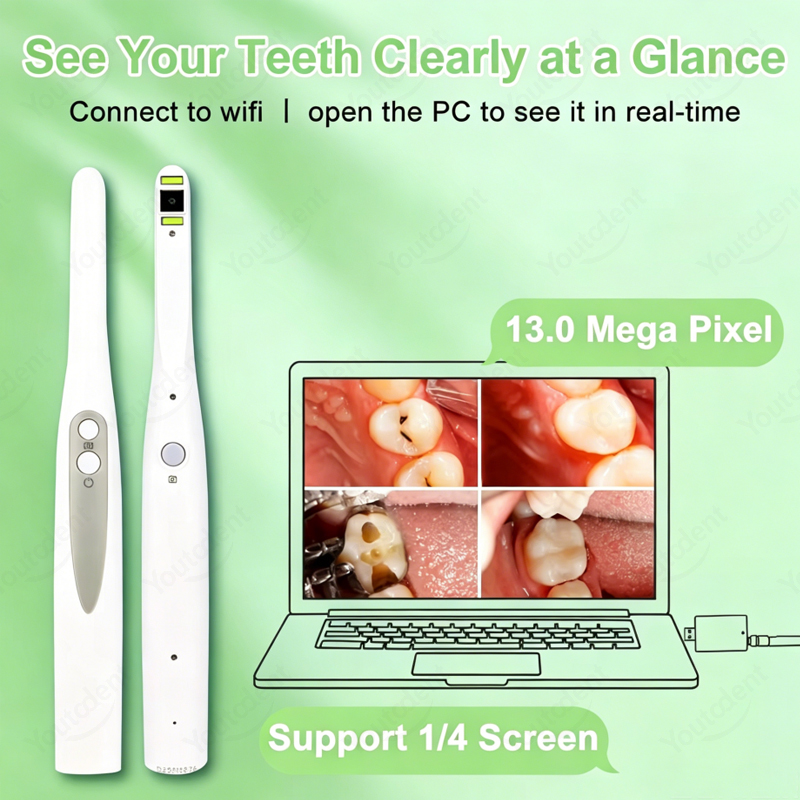 กล้องตรวจช่องปากไร้สาย WIFI คว - Endoscope Inspection Camera บทวิจารณ์และราคา